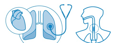 A decorative image showing a stethoscope, a heart, and a set of lungs, representing the different ways NOx can impact human health and A decorative image illustrating an inflamed airway, one of the potential health impacts of short-term exposure to NOx.